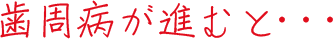 歯周病が進むと…