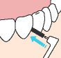 2.フロスを歯面に沿わせながら、ゆっくりと歯と歯の間に入れ、歯面に沿うように上下に動かします。