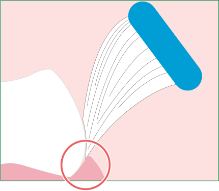歯と歯ぐきの間図